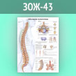 Плакат «Заболевания позвоночника» (ЗОЖ-43, ламинир. бумага, А1, 1 лист)
